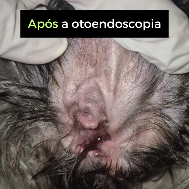 Depois da otoendoscopia: conduto auditivo limpo